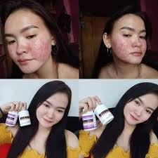 Frontrow Japan by: Pakner