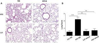 Normal fetal lung, canalicular phase, medium power microscopic. Lung Tissue Histology A Representative Hematoxylin Eosin Stained Download Scientific Diagram