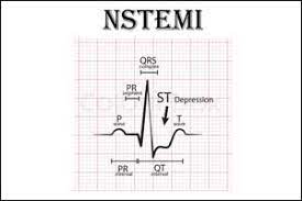 Alternatively search google for nste. No Advantage Of Early Angiography In Nste Acs Patients Esc 2018