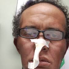 Fundraiser by Marcus Stepto : Help for living expenses during cancer  treatments