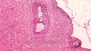 Image result for Phyllanthus muellerianus