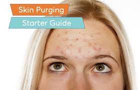 Jun 25, 2019 · generally speaking, dermatologists say purging should be over within four to six weeks of starting a new skin care regimen. Acne Purging Full Dermatologist Guide Mdacne