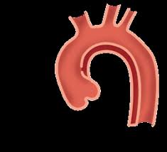 Falithrom® setzt die gerinnungsfähigkeit des blutes herab, deshalb erfordert die einnahme dieses medikamentes ihre. Https Www Dhzb De Fileadmin User Upload Relaunch 11 Downloads Patientenratgeber Aorta 02 2019 Pdf