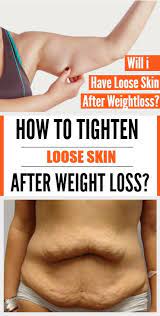 When you gain a lot of weight, your skin stretches to accommodate that growth. Pin On Live Healthy