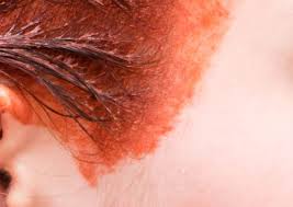The bottom line of what i'm saying is; 20 Ways To Get Hair Dye Off Your Skin And Out Of Your Clothes How To Get Hair Dye Off Skin And Clothes