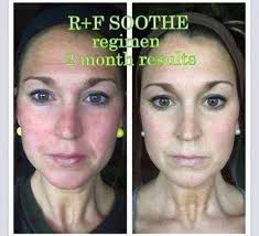 This might be the cutest thing ever released 💞 Soothing & Barrier Support  Serum helps address damaged skin barrier concerns, such as dryness, redness  and feelings of discomfort. And now, you can