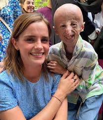 The first day they met.. (2001) f /SarcasmLol The last day