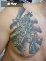 Can hair be removed with laser over tattoos. Laser Tattoo Removal Examples By Light Fantastic Ipl