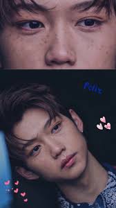 Felix Felix Stray Kids Freckles Felix