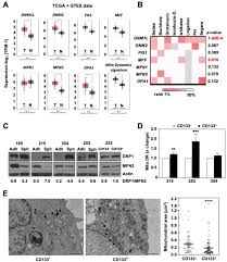 Mitochondrial fission is associated to stemness in human PDAC. A, B....