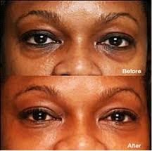 How would you like to look instantly 10 years younger? How To Look 10 Years Younger Sisiyemmie Nigerian Food Lifestyle Blog