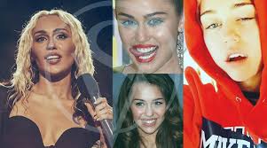 Why Miley Cyrus' Teeth Makeover Sparks Debate Among Top Dentists Worldwide