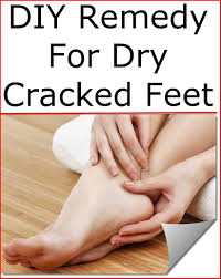 The right foot cream can smooth out dry skin, cracked heels, and calluses. Listerine Vinegar Foot Soaks And Uses Listerinefo6m18 On Flipboard