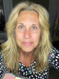 Did QVC host have facial work done?