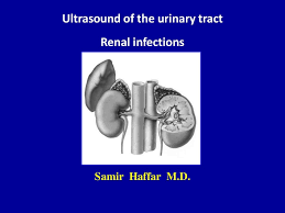 Ultrasound Of The Urinary Tract Renal Infections Urinary Tract Renal Ultrasound