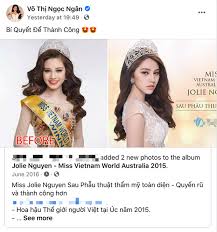 Phẫu thuật thẩm mỹ để trở thành thần tượng và lí do rời snh48? Ngan 98 Bá»‹ Chá»‰ Trich Vi Nghi Ca Khá»‹a Jolie Nguyá»…n Tin Tá»©c Online