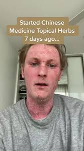 Chinese Medicine Dermatology with Dr. Olivia Friedman