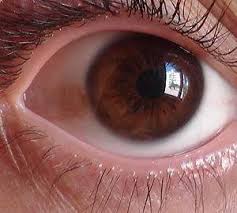 Manchas En Los Ojos Aqui Te Explicamos A Que Se Debe Nova Vision