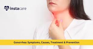 Image result for gonorrhea symptoms