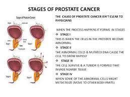 A diagnosis of lung cancer naturally causes some overwhelming emotions, but you don't have to let those emotions get the best of you. Prostate Cancer Cause Defined Symptom Risk Factors