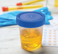 Dogs that are suffering from bladder cancer will be in pain and will exhibit signs of having difficulty urinating. The Pet Oncologist Vet Oncologist Online Bladder Prostate Cancer In Dogs