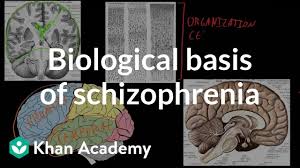Schizophrenia is characterized by distortions in thinking, perception, emotions, language, sense of self and behaviour. Biological Basis Of Schizophrenia Video Khan Academy