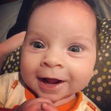 Baby S Head 1st Percentile Babycenter