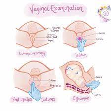 Vaginal examinations can be seen as less harmful than induction or episiotomies. Vaginal Examination In Student Midwife Studygram Facebook