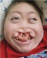 Joseph "Bubba" Beck Obituary (1992