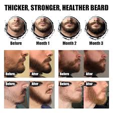 The diversity of facial hair growth depends on genetics. Buy Beard Growth Oil 2 Pack Beard Growth Kit With Castor Oil Serum Conditioner For Men Beard Growth Stimulate Patchy Beard Beard Mustache Facial Hair Growth Promote A Fuller Thicker Stronger Beard Online