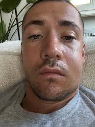 Off season so far 💍🌊🏌️‍♂️🦷 📸: @julialoefflerfotografie