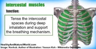 Intercostal Muscle Strain Causes Symptoms And Effective Treatments Intercostal Muscle Strain Muscle Strain Muscle Tear