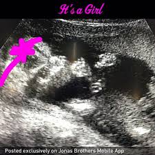 Pertama, pasien akan diminta untuk mengenakan pakaian khusus yang telah disediakan pihak rumah sakit untuk. Hasil Usg Jenis Kelamin Bayi Perempuan Gambar Cewek Buat Quotes