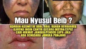 Hati Hati Beredar Kosmetik Abal Abal Kimia Perawatan Wajah Pembersih Wajah