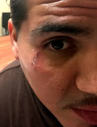 Laugh now, cry later, play now, pay later, and my happy life, my sad life are just a few. Removing Gang Tattoos A Life And Death Thing Wbez Chicago