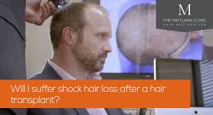 This will lead to hair falling. Will I Suffer Shock Hair Loss After A Hair Transplant True Answer