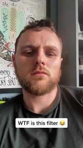 WTF is this filter #beesting #hugelips #filter #fypシ #fyp #foryou