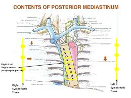 Mediastinum computed tomography (ct) is indispensable in imaging the mediastinum. Ppt The Mediastinum Powerpoint Presentation Free Download Id 2491528