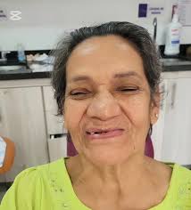 Por qué mereces una sonrisa que te haga sentir invencible., Recupérala en  SANDRA TELLO ODONTOLOGÍA, #transformacióndental #confianzaquesenota  #rehabilitacionoral #antesydespues , ☎️ 323 4737544, ...