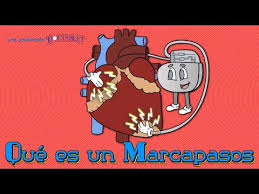 La contracción muscular del músculo cardíaco en los animales se inicia por los impulsos eléctricos conocidos como potencial de acción. Video Marcapasos