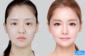 Pin On Before After