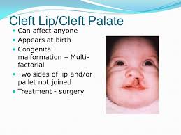 PRENATAL INTRO & BIRTH DEFECTS AFTER CONCEPTION…..