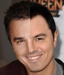 Seth MacFarlane Hair Transplant Did He Enhance His Hairline?