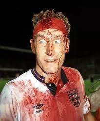 El ex jugador inglés con corazón de león Terry Butcher cubierto de sangre  tras una lesión en la cabeza durante una clasificación para la Copa Mundial  de 1990 contra Suecia. ⚽️ Terry