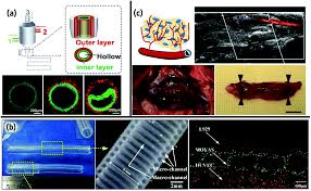 Barros hermida ricardo;barros hermida juan manuel. Recent Progress In Extrusion 3d Bioprinting Of Hydrogel Biomaterials For Tissue Regeneration A Comprehensive Review With Focus On Advanced Fabricatio Biomaterials Science Rsc Publishing Doi 10 1039 D0bm00973c