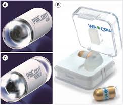 Image result for Wireless Capsule Endoscopy