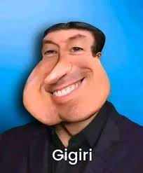 Habías oído hablar del querubismo? El querubismo es una condición médica  rara que afecta el desarrollo de los huesos de la cara, particularmente los  maxilares. Se caracteriza por una hinchazón bilateral de