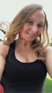 頭蝨症狀】美國女子4歲時生頭蝨母親汽油淋頭3級燒傷終身毀容