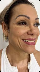 Para las personas que han pedido fotos más naturales de mi paciente antes  de los Bioestimuladores de colágeno, aquí están fotos de cuando inicié el  trabajo de #armonizacionfacial y las actuales a 2 ...