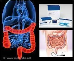 Non Invasive Test Optimizes Colon Cancer Screening Rates Study Colon Cancer Pinterest Cancer Colon Cancer And Cancer Treatment